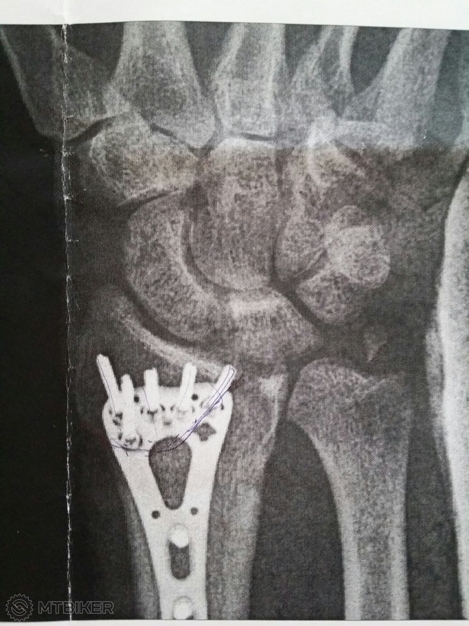 2014-11-19 10.28.14.jpg